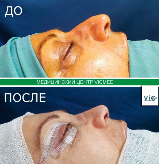 Доктор Ашот Торосян - пластический хирург