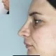 Доктор Рубен Согоян-пластический хирург Доктор Рубен Согоян-пластический хирург