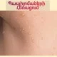 Доктор Рубен Согоян-пластический хирург Доктор Рубен Согоян-пластический хирург