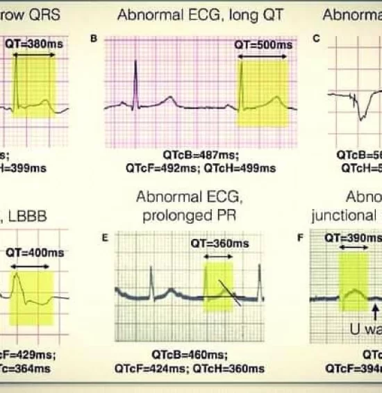 For students Clinical Cardiology